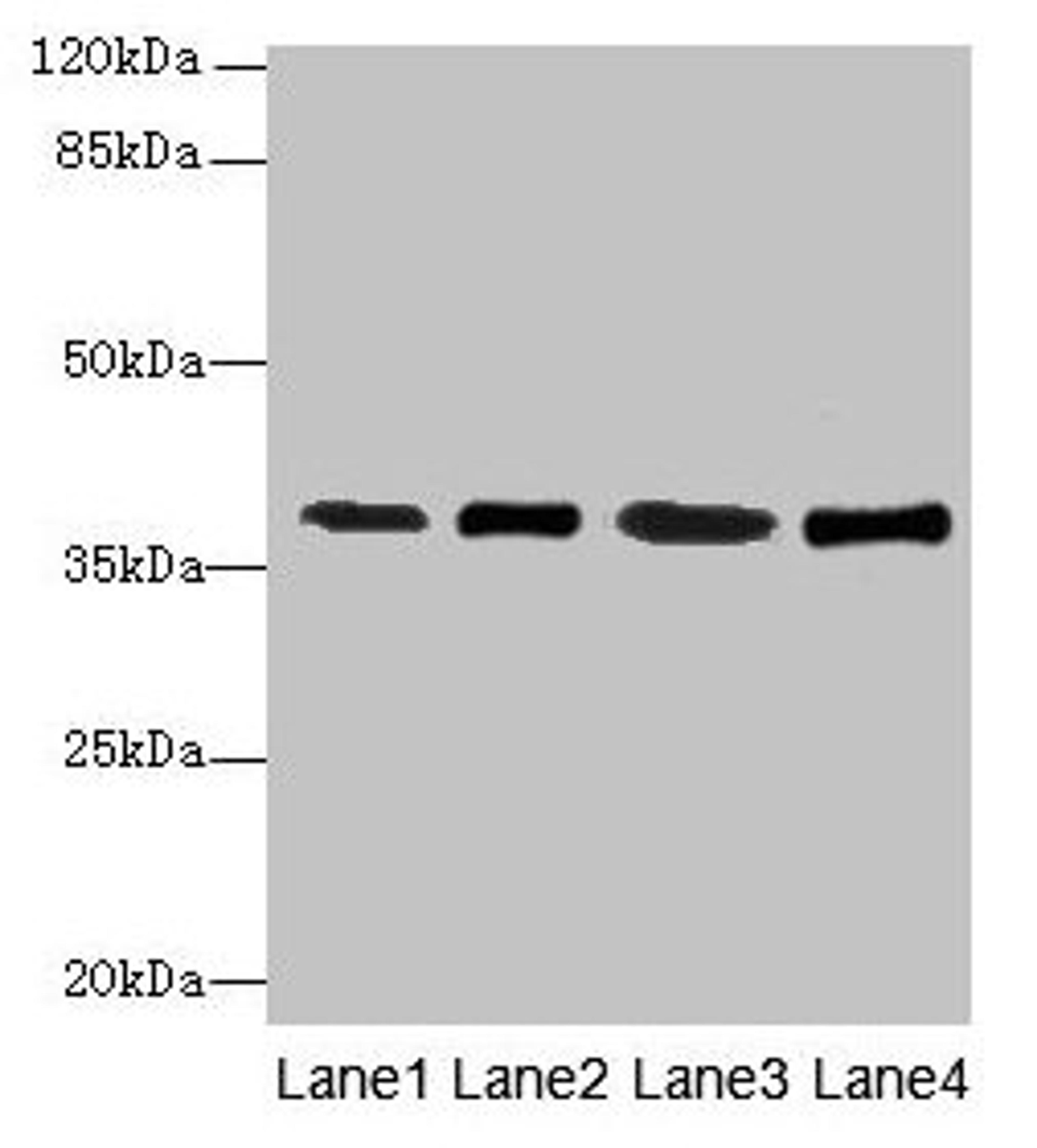 Western blot. All lanes: SFXN4 antibody at 0.3µg/ml. Lane 1: K562 whole cell lysate. Lane 2: U251 whole cell lysate. Lane 3: U87 whole cell lysate. Lane 4: A549 whole cell lysate. Secondary. Goat polyclonal to rabbit IgG at 1/10000 dilution. Predicted band size: 38, 35, 25 kDa. Observed band size: 38 kDa