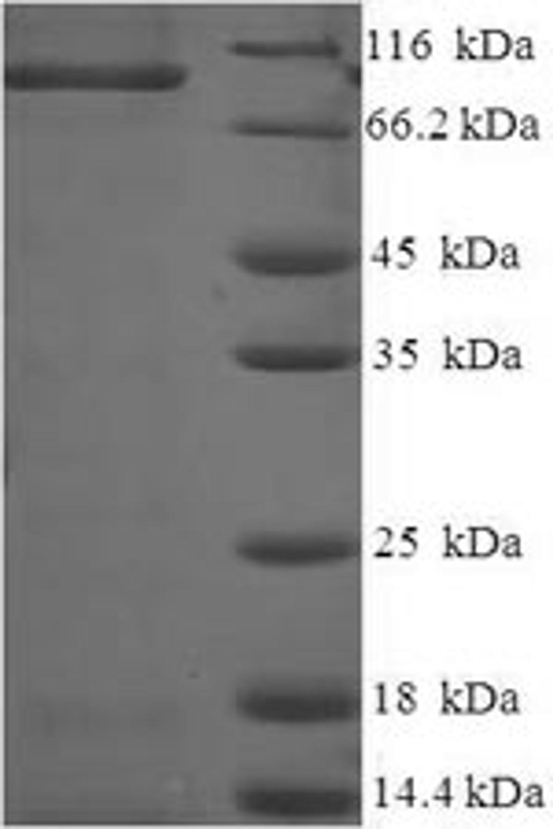 (Tris-Glycine gel) Discontinuous SDS-PAGE (reduced) with 5% enrichment gel and 15% separation gel.