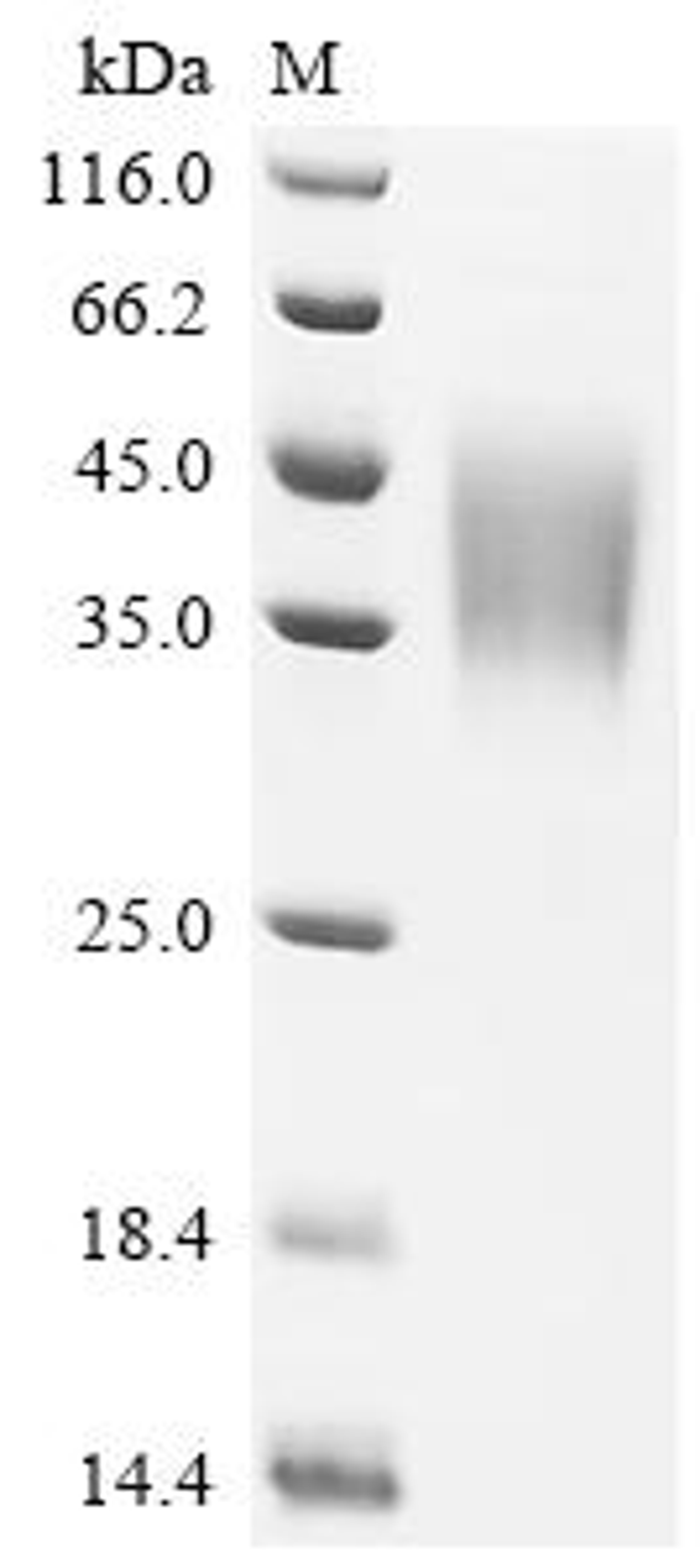 (Tris-Glycine gel) Discontinuous SDS-PAGE (reduced) with 5% enrichment gel and 15% separation gel.