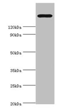 Western blot. All lanes: TRPM2 antibody at 2µg/ml + K562 whole cell lysate. Secondary. Goat polyclonal to rabbit IgG at 1/10000 dilution. Predicted band size: 172, 166, 96 kDa. Observed band size: 172 kDa