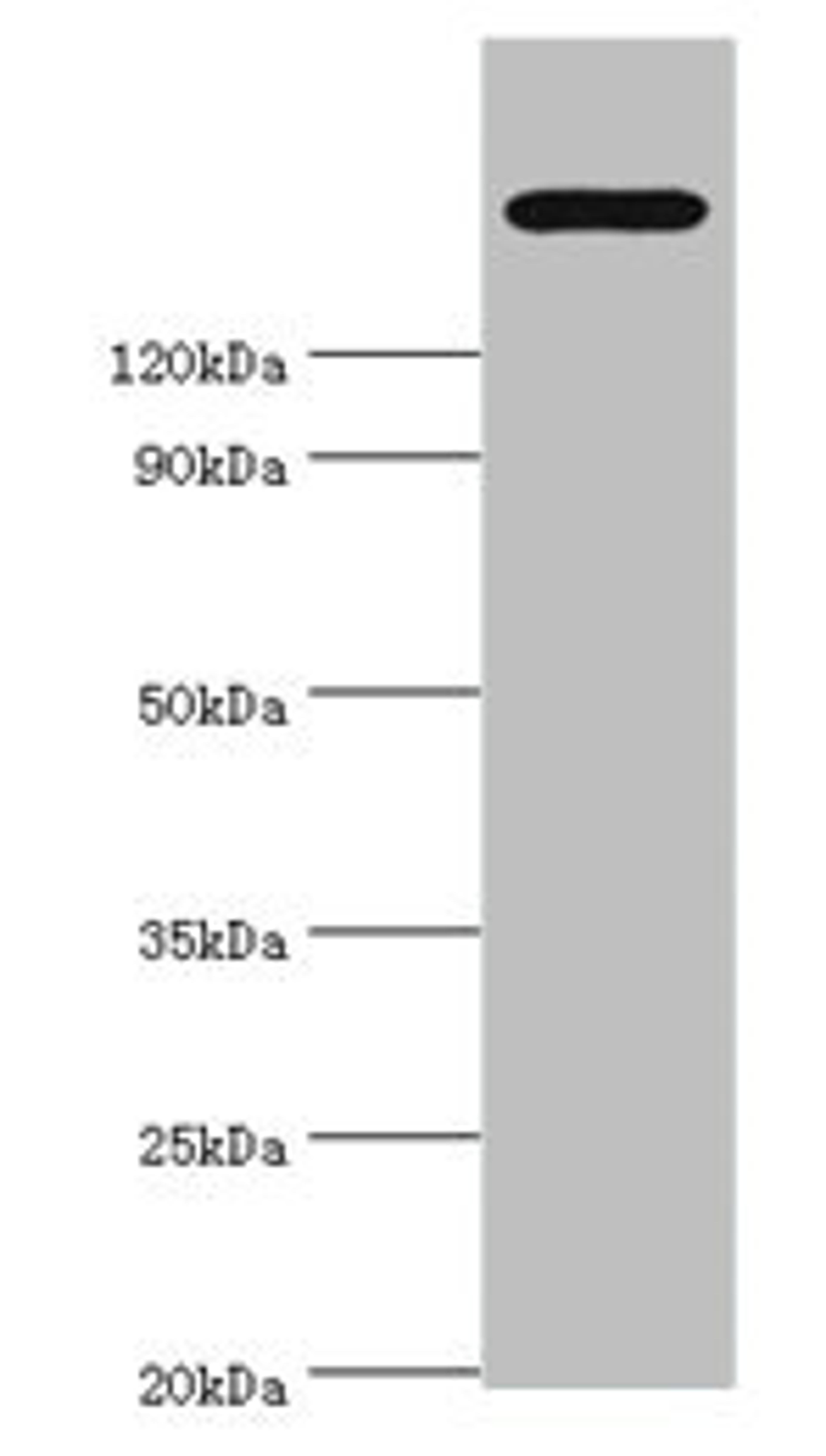 Western blot. All lanes: TRPM2 antibody at 2µg/ml + K562 whole cell lysate. Secondary. Goat polyclonal to rabbit IgG at 1/10000 dilution. Predicted band size: 172, 166, 96 kDa. Observed band size: 172 kDa