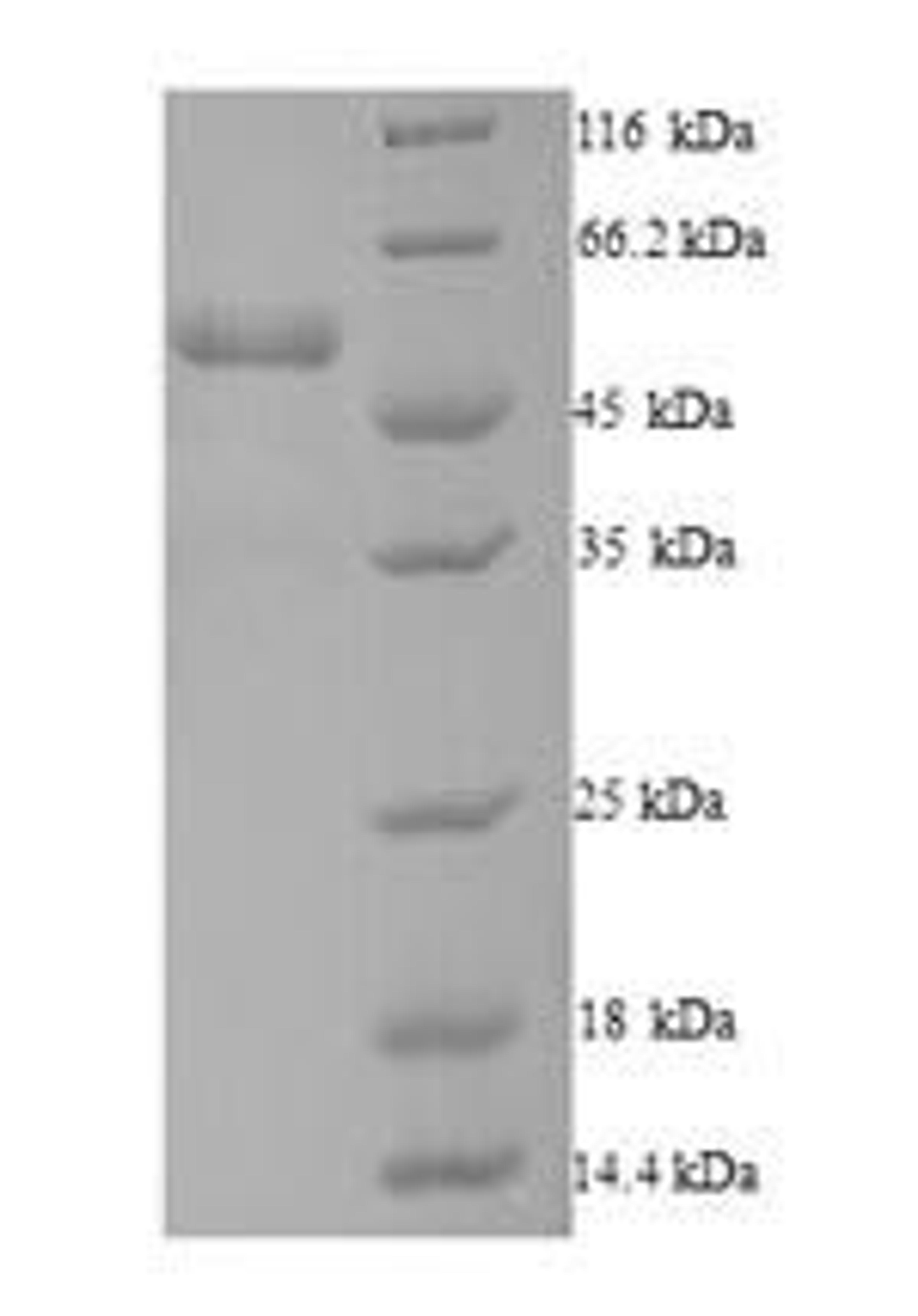 (Tris-Glycine gel) Discontinuous SDS-PAGE (reduced) with 5% enrichment gel and 15% separation gel.