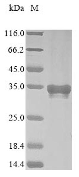 (Tris-Glycine gel) Discontinuous SDS-PAGE (reduced) with 5% enrichment gel and 15% separation gel.