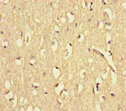 Immunohistochemistry of paraffin-embedded human brain tissue using CSB-PA861133HA01HU at dilution of 1:100