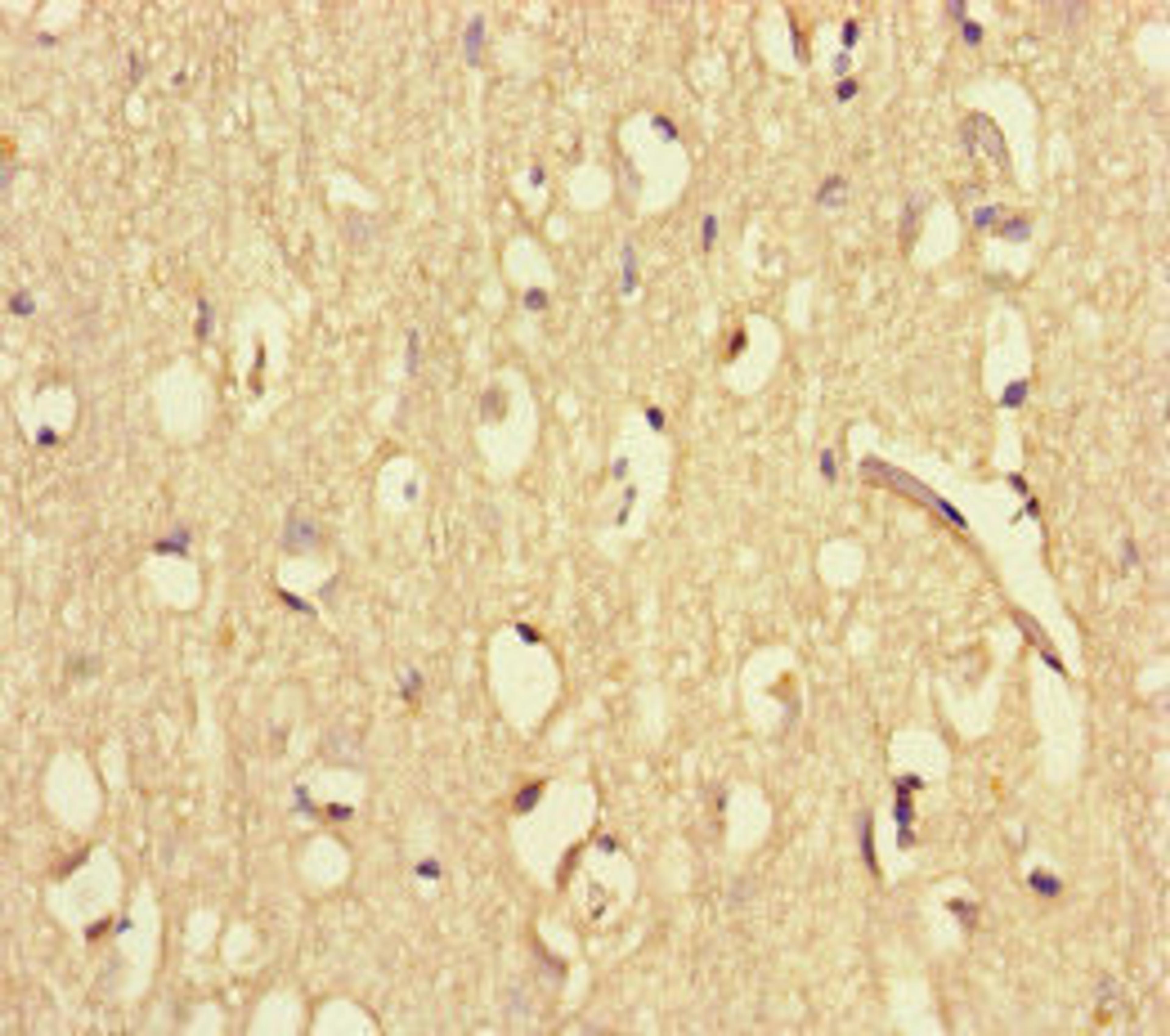 Immunohistochemistry of paraffin-embedded human brain tissue using CSB-PA861133HA01HU at dilution of 1:100