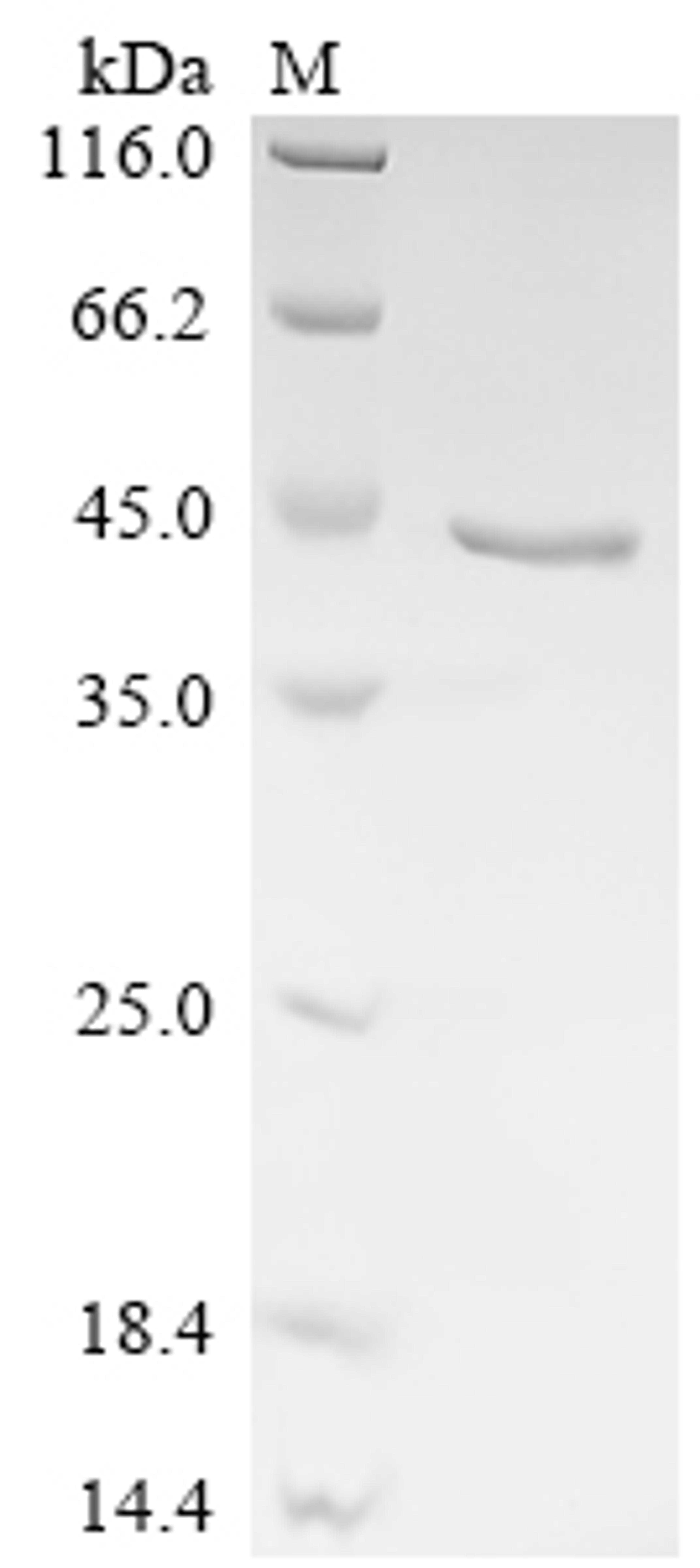 (Tris-Glycine gel) Discontinuous SDS-PAGE (reduced) with 5% enrichment gel and 15% separation gel.