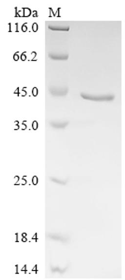 (Tris-Glycine gel) Discontinuous SDS-PAGE (reduced) with 5% enrichment gel and 15% separation gel.