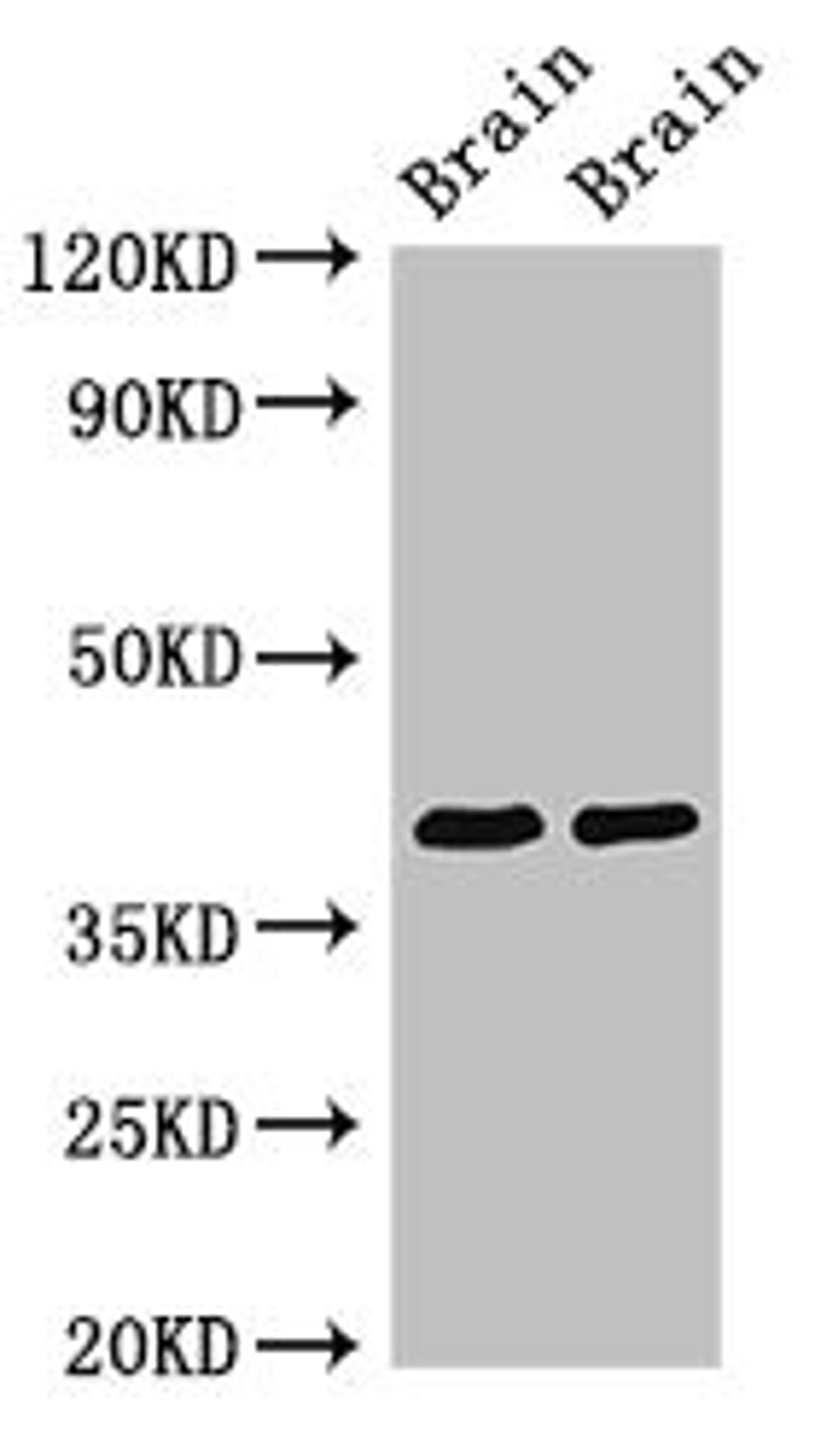 Western Blot. Positive WB detected in: Rat brain tissue, Mouse brain tissue. All lanes: STOML3 antibody at 3.4ug/ml. Secondary. Goat polyclonal to rabbit IgG at 1/50000 dilution. Predicted band size: 33, 32 kDa. Observed band size: 40 kDa.