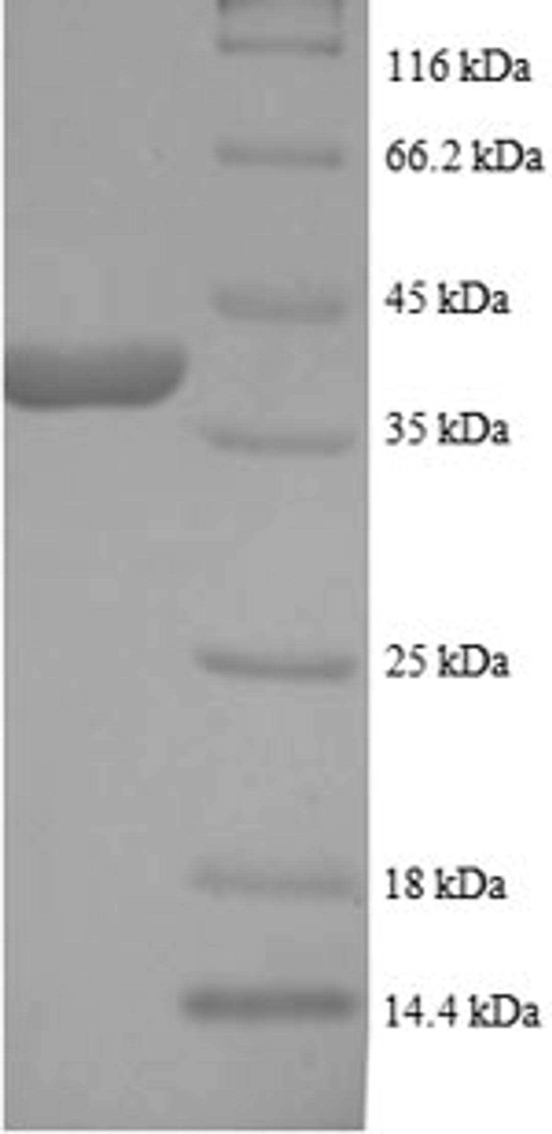 (Tris-Glycine gel) Discontinuous SDS-PAGE (reduced) with 5% enrichment gel and 15% separation gel.