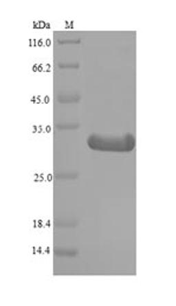 (Tris-Glycine gel) Discontinuous SDS-PAGE (reduced) with 5% enrichment gel and 15% separation gel.
