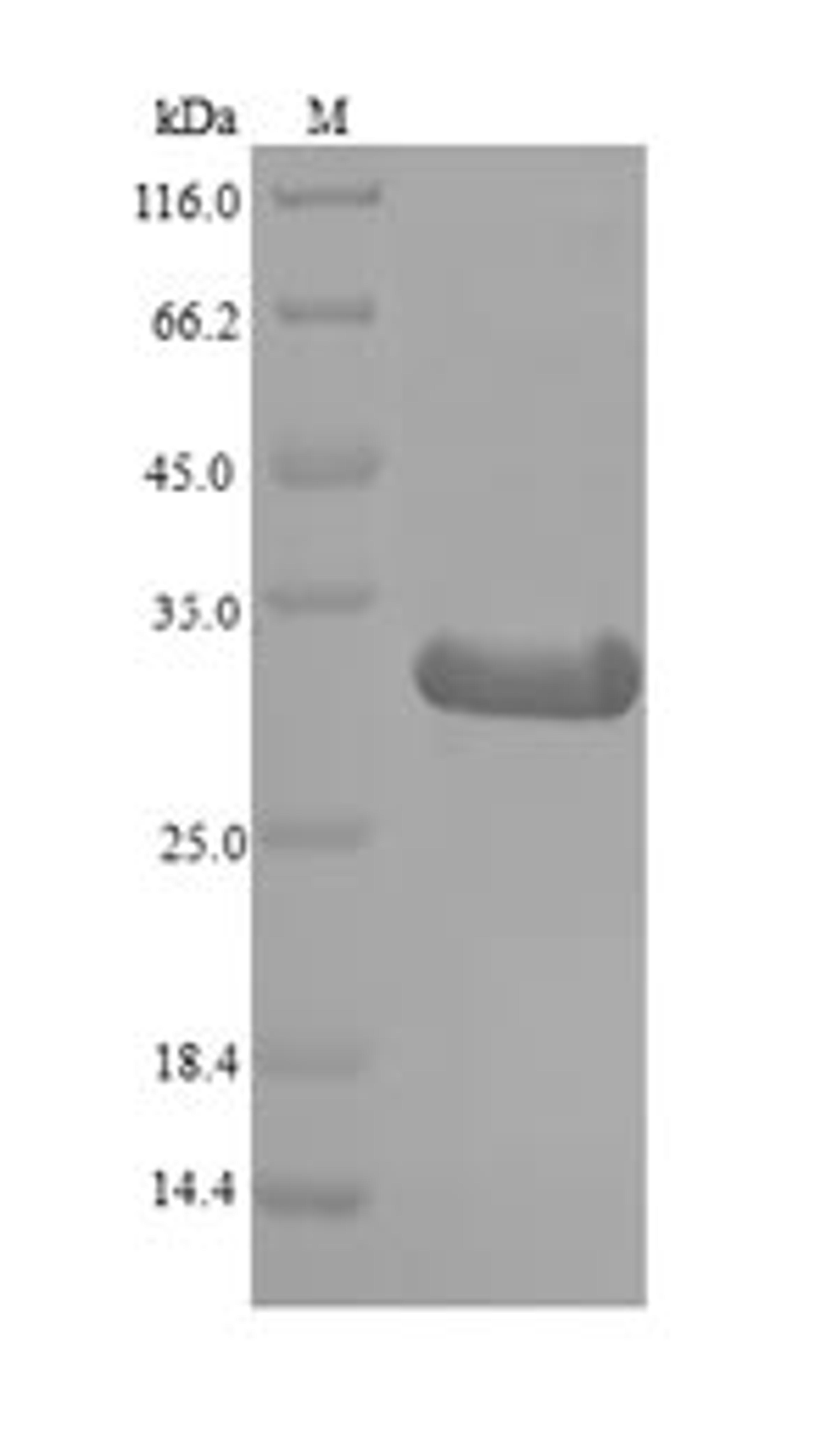(Tris-Glycine gel) Discontinuous SDS-PAGE (reduced) with 5% enrichment gel and 15% separation gel.