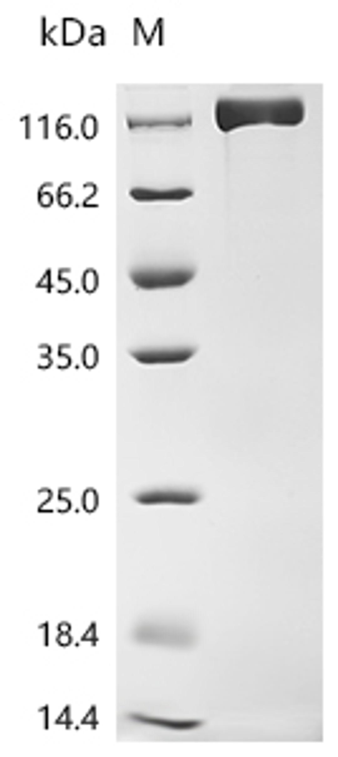 (Tris-Glycine gel) Discontinuous SDS-PAGE (reduced) with 5% enrichment gel and 15% separation gel.