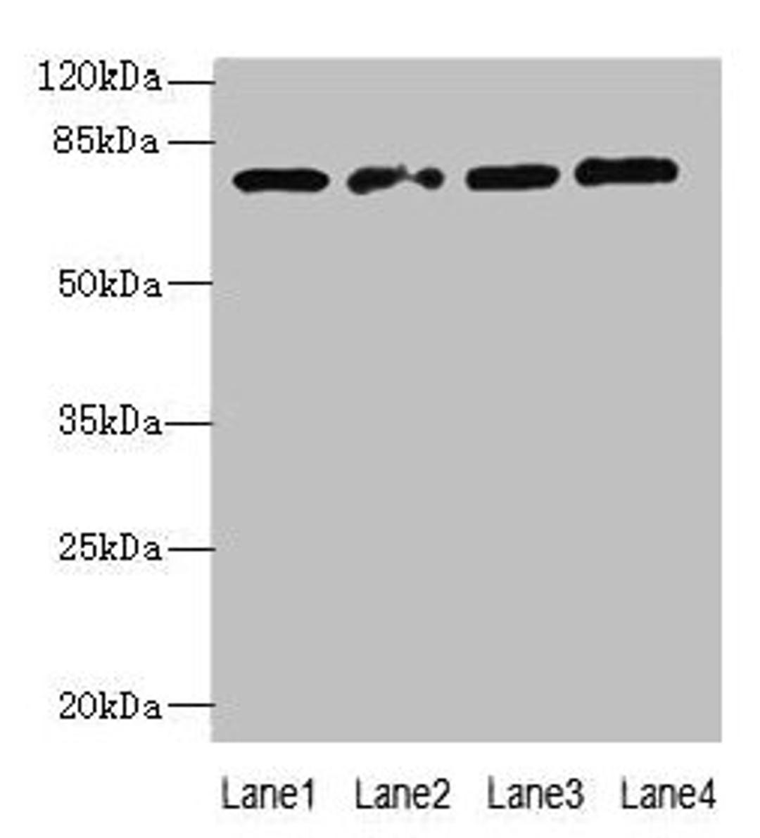 Western blot. All lanes: TBC1D14 antibody at 4ug/ml. Lane 1: K562 whole cell lysate. Lane 2: U87 whole cell lysate. Lane 3: A549 whole cell lysate. Lane 4: HepG2 whole cell lysate. Secondary. Goat polyclonal to rabbit IgG at 1/10000 dilution. Predicted band size: 79, 48 kDa. Observed band size: 79 kDa. 