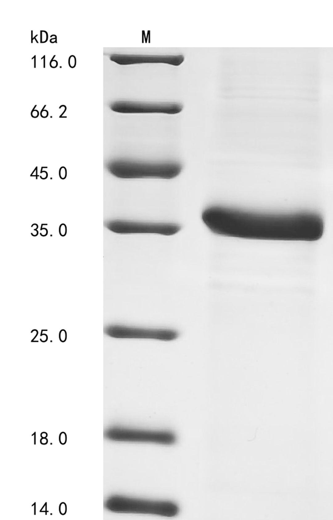 (Tris-Glycine gel) Discontinuous SDS-PAGE (reduced) with 5% enrichment gel and 15% separation gel.