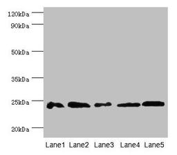 Western blot. All lanes: Gstp1 antibody at 2µg/ml. Lane 1: Mouse kidney tissue. Lane 2: Jurkat whole cell lysate. Lane 3: K562 whole cell lysate. Lane 4: 293T whole cell lysate. Lane 5: Hela whole cell lysate. Secondary. Goat polyclonal to rabbit IgG at 1/10000 dilution. Predicted band size: 24 kDa. Observed band size: 24 kDa