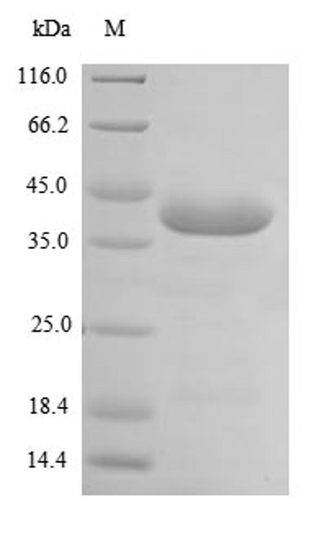(Tris-Glycine gel) Discontinuous SDS-PAGE (reduced) with 5% enrichment gel and 15% separation gel.