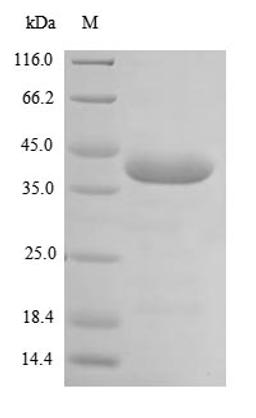 (Tris-Glycine gel) Discontinuous SDS-PAGE (reduced) with 5% enrichment gel and 15% separation gel.