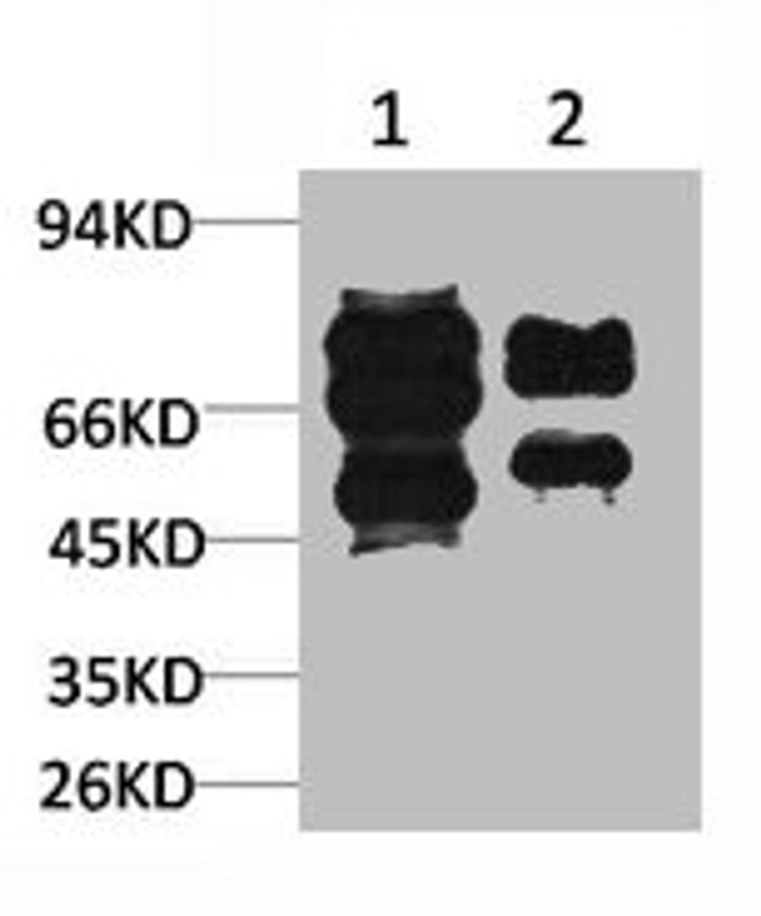 Western blot analysis of 1) Mouse Brain Tissue, 2)Rat Brain Tissue with GABA A Receptor γ2 Rabbit pAb diluted at 1:2,000.