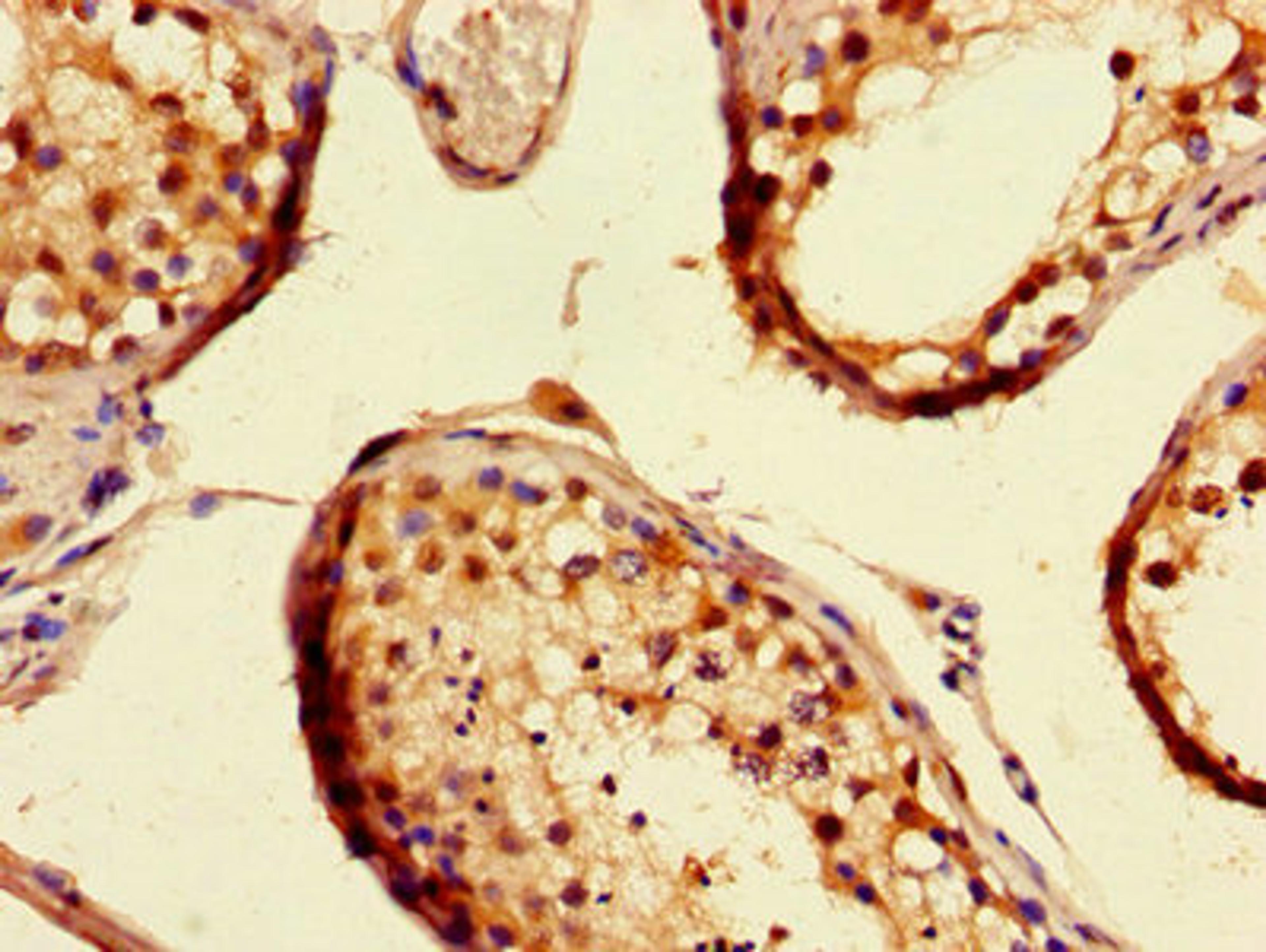 Immunohistochemistry of paraffin-embedded human testis tissue using CSB-PA013427LA01HU at dilution of 1:100
