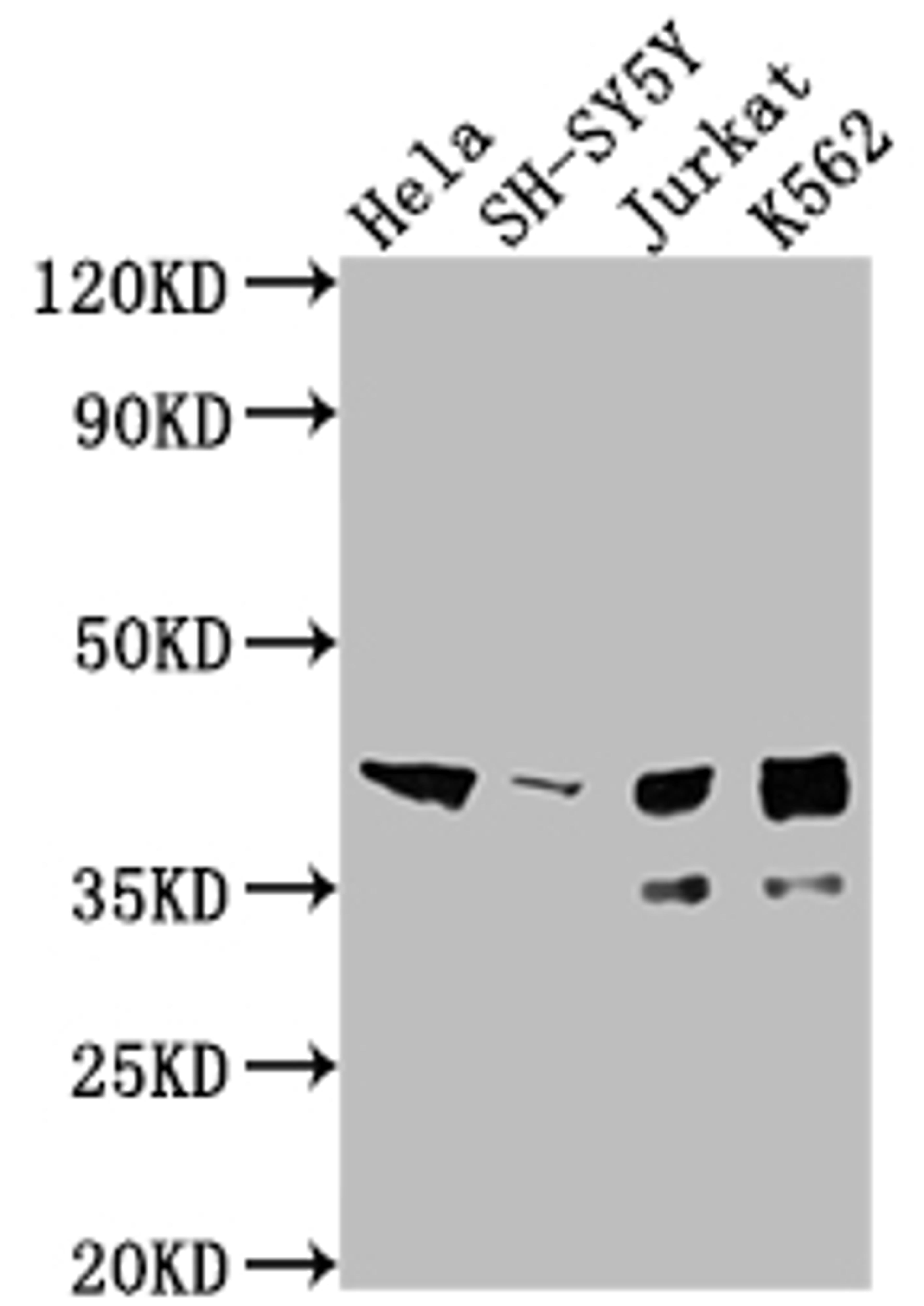 Western Blot. Positive WB detected in: Hela whole cell lysate, SH-SY5Y whole cell lysate, Jurkat whole cell lysate, K562 whole cell lysate. All lanes: ISL1 antibody at 1:2000. Secondary. Goat polyclonal to rabbit IgG at 1/50000 dilution. Predicted band size: 40 kDa. Observed band size: 39 kDa. 