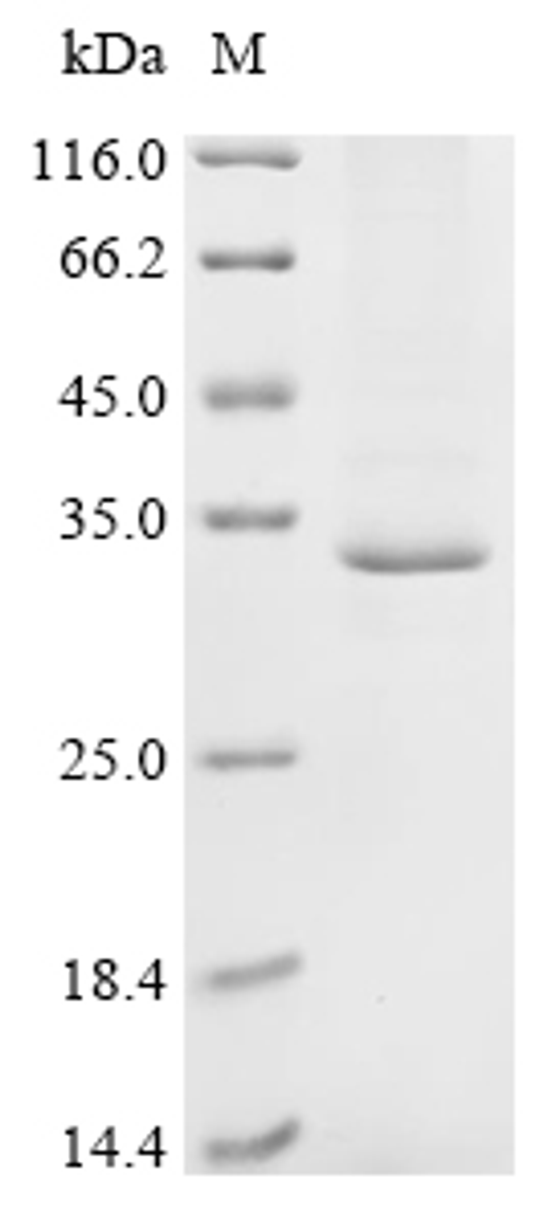 (Tris-Glycine gel) Discontinuous SDS-PAGE (reduced) with 5% enrichment gel and 15% separation gel.