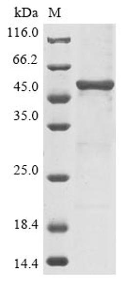 (Tris-Glycine gel) Discontinuous SDS-PAGE (reduced) with 5% enrichment gel and 15% separation gel.