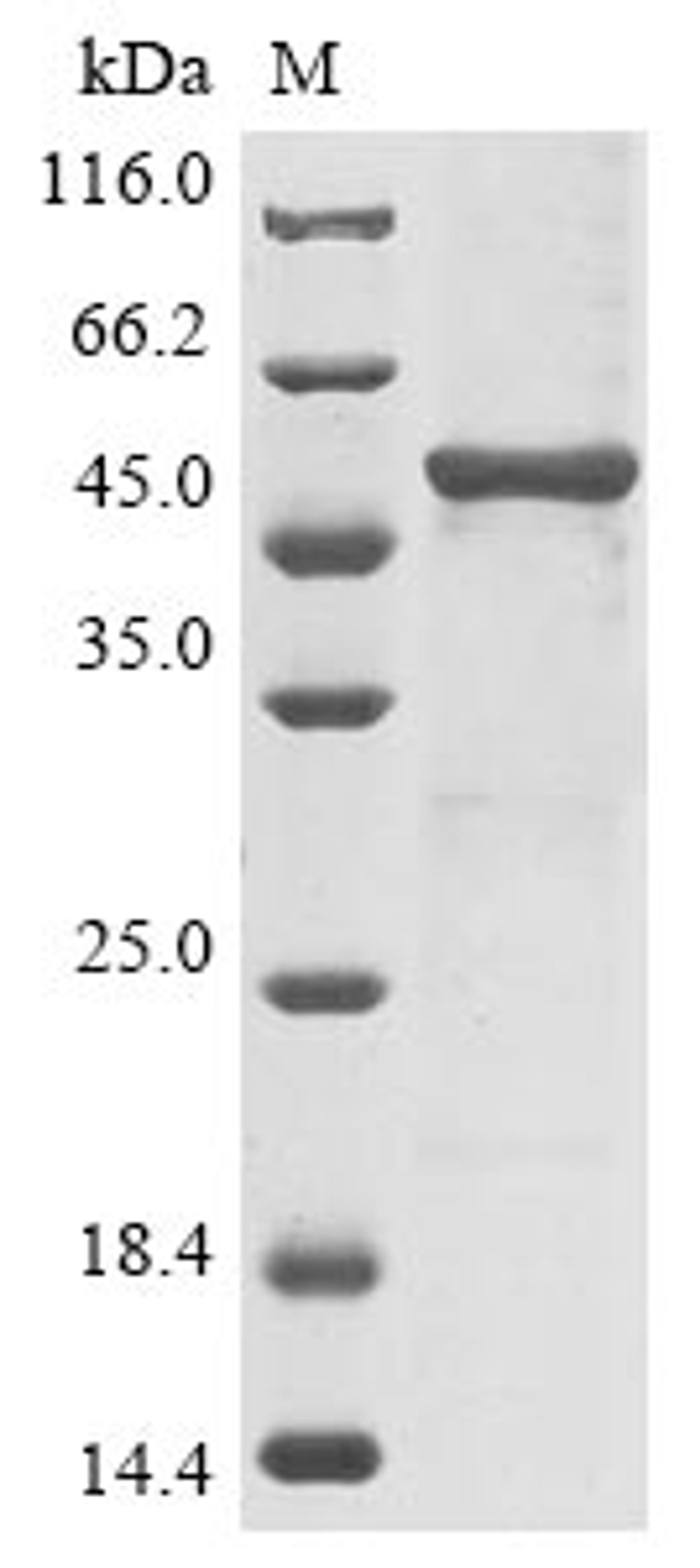 (Tris-Glycine gel) Discontinuous SDS-PAGE (reduced) with 5% enrichment gel and 15% separation gel.