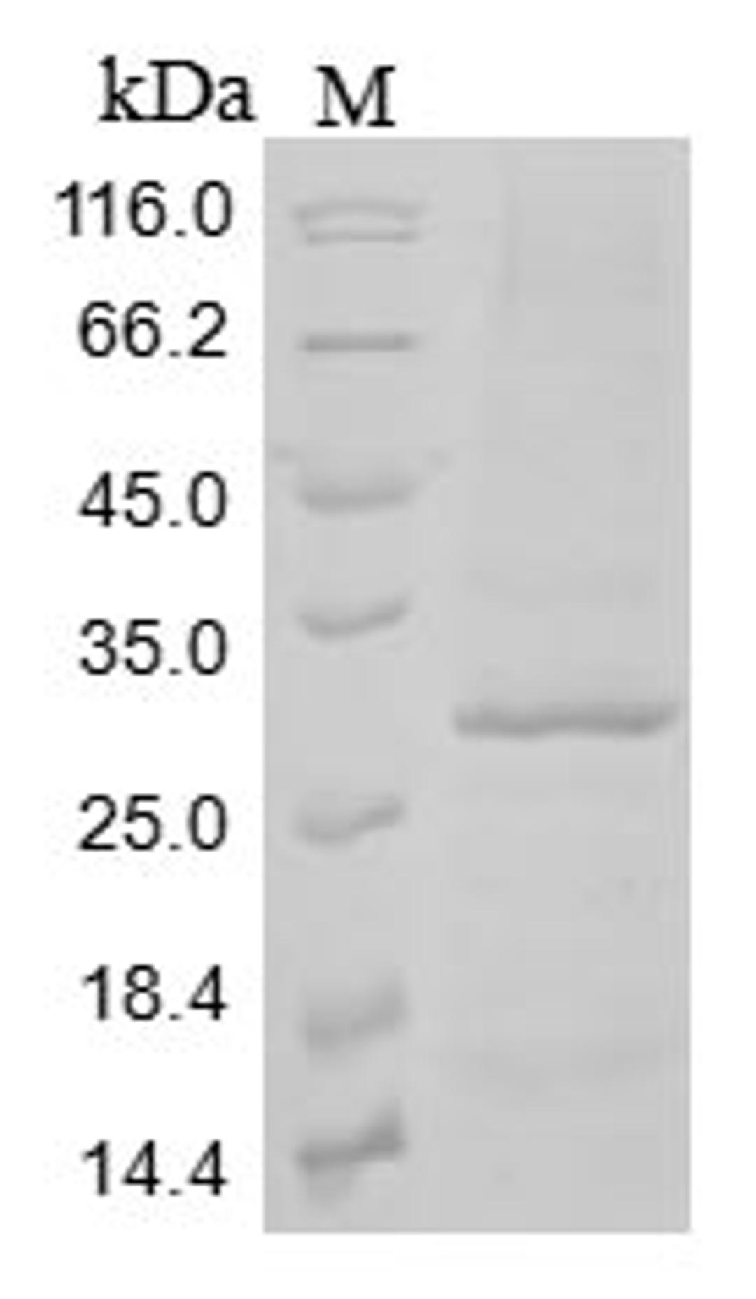 (Tris-Glycine gel) Discontinuous SDS-PAGE (reduced) with 5% enrichment gel and 15% separation gel.