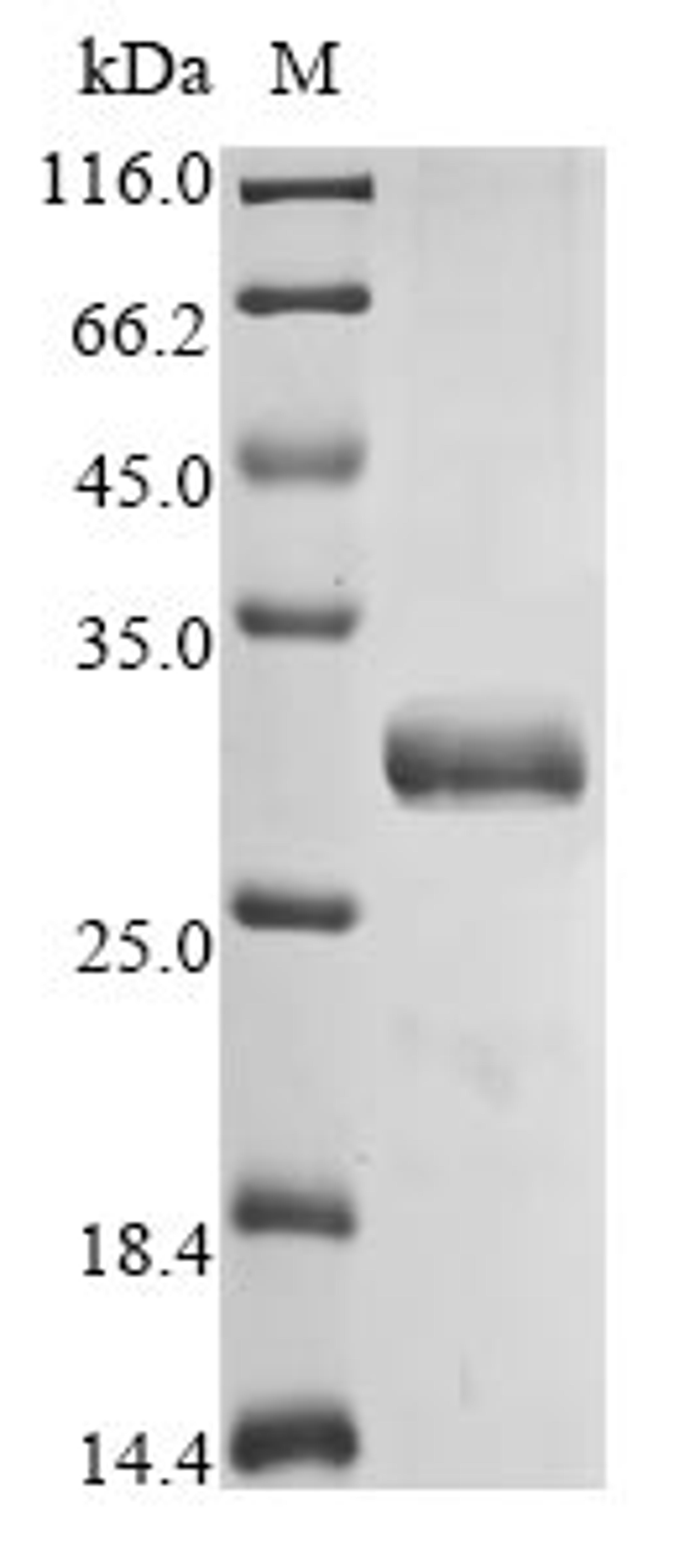 (Tris-Glycine gel) Discontinuous SDS-PAGE (reduced) with 5% enrichment gel and 15% separation gel.