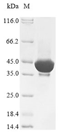 (Tris-Glycine gel) Discontinuous SDS-PAGE (reduced) with 5% enrichment gel and 15% separation gel.