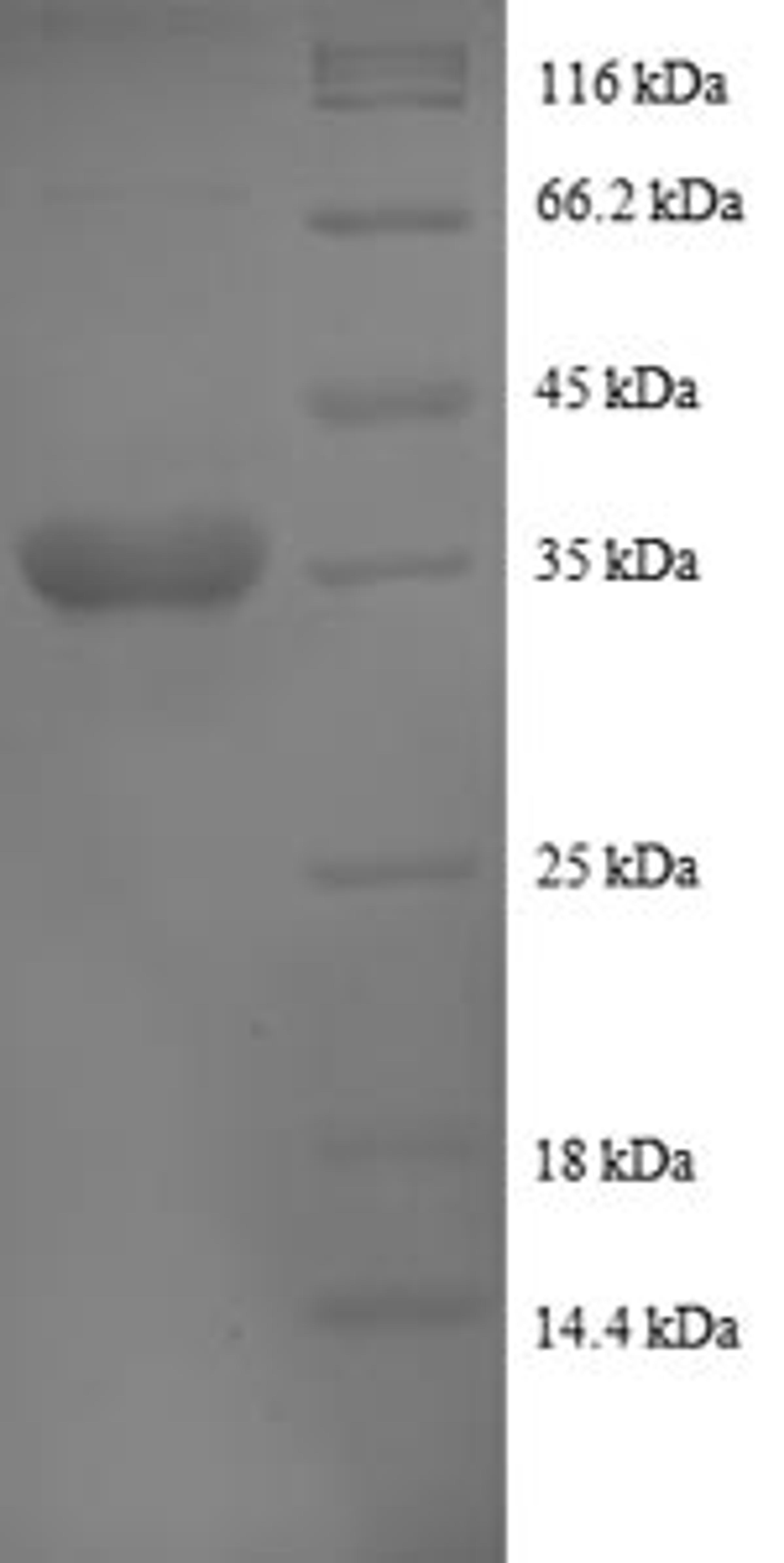 (Tris-Glycine gel) Discontinuous SDS-PAGE (reduced) with 5% enrichment gel and 15% separation gel.