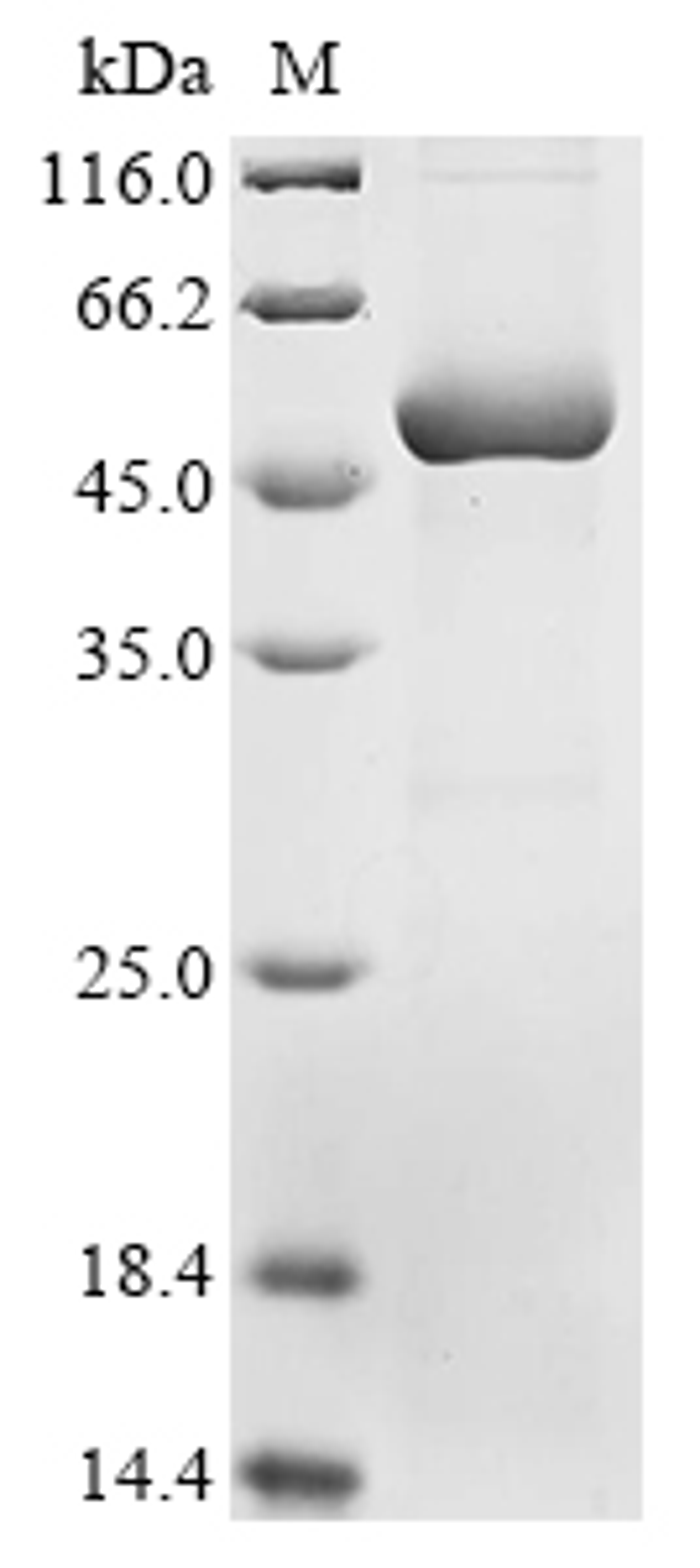 (Tris-Glycine gel) Discontinuous SDS-PAGE (reduced) with 5% enrichment gel and 15% separation gel.
