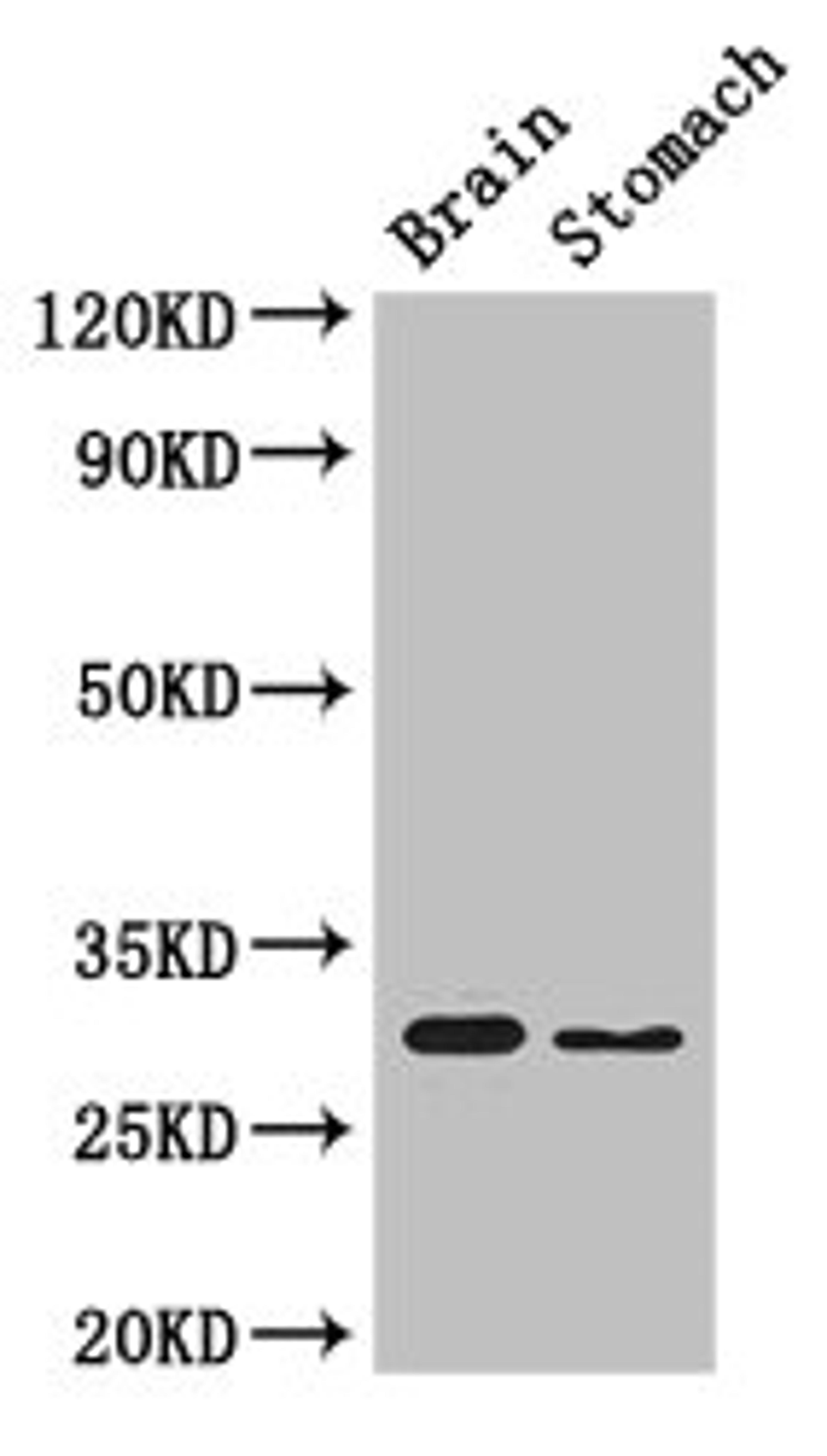Western Blot. Positive WB detected in: Mouse brain tissue, Mouse stomach tissue. All lanes: COPS7B antibody at 3µg/ml. Secondary. Goat polyclonal to rabbit IgG at 1/50000 dilution. Predicted band size: 30, 19, 31 kDa. Observed band size: 30 kDa