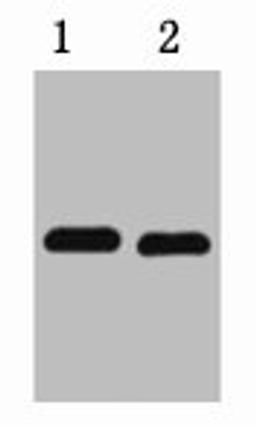 1ug mCherry fusion protein+ Primary antibody dilution at  1) 1:5000 2) 1:10000