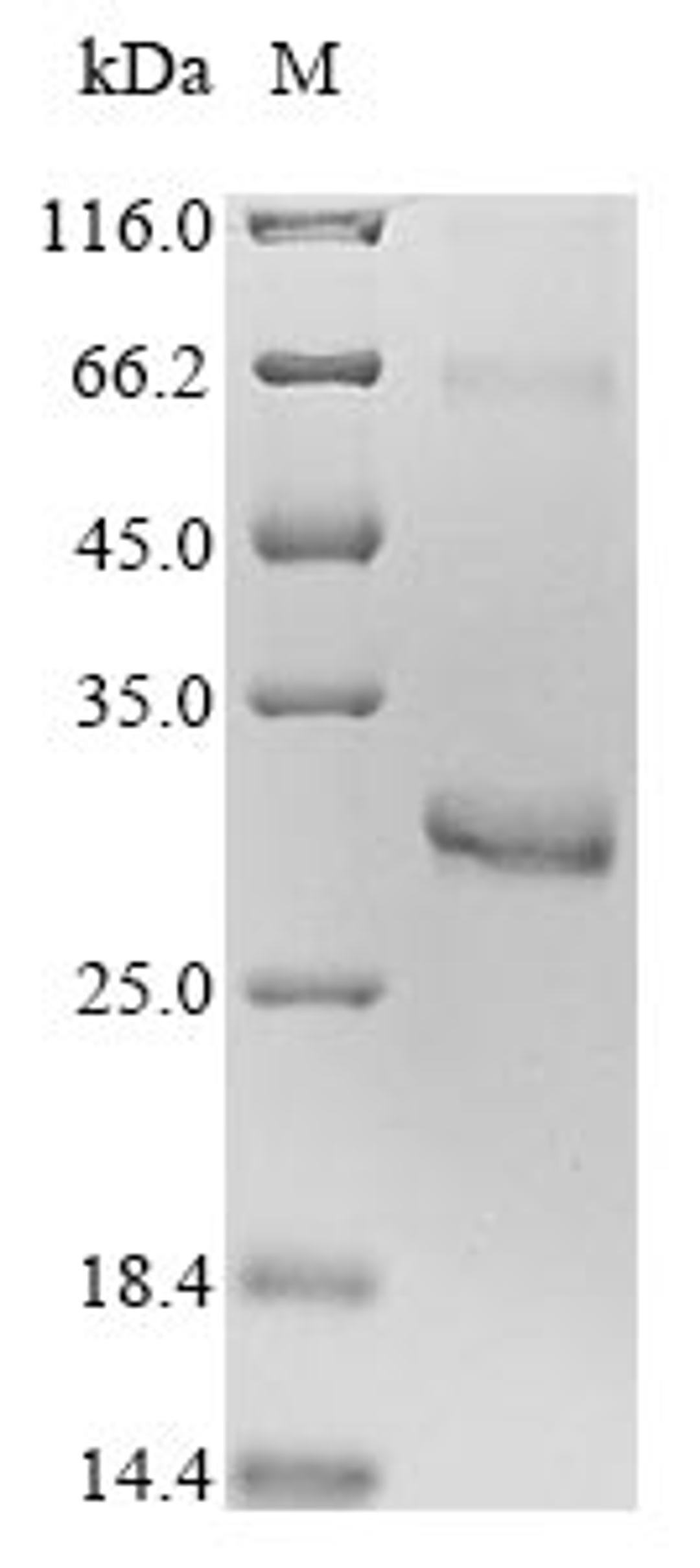 (Tris-Glycine gel) Discontinuous SDS-PAGE (reduced) with 5% enrichment gel and 15% separation gel.