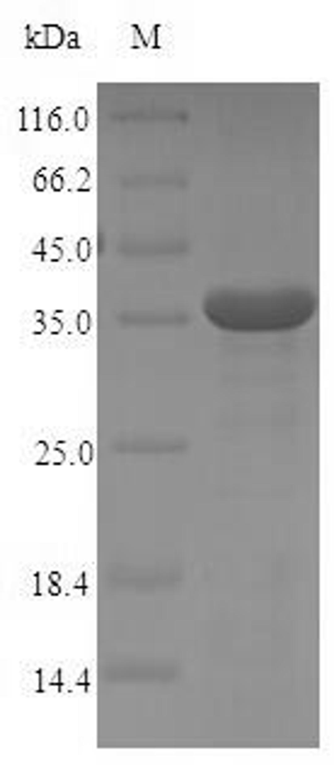 (Tris-Glycine gel) Discontinuous SDS-PAGE (reduced) with 5% enrichment gel and 15% separation gel.