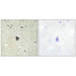 Immunohistochemistry analysis of paraffin-embedded human brain tissue using CSFR (Ab-809) antibody.