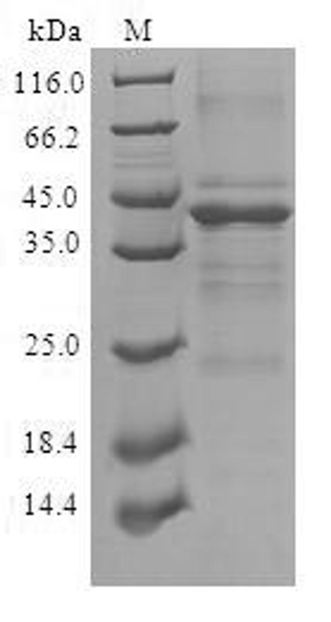 (Tris-Glycine gel) Discontinuous SDS-PAGE (reduced) with 5% enrichment gel and 15% separation gel.