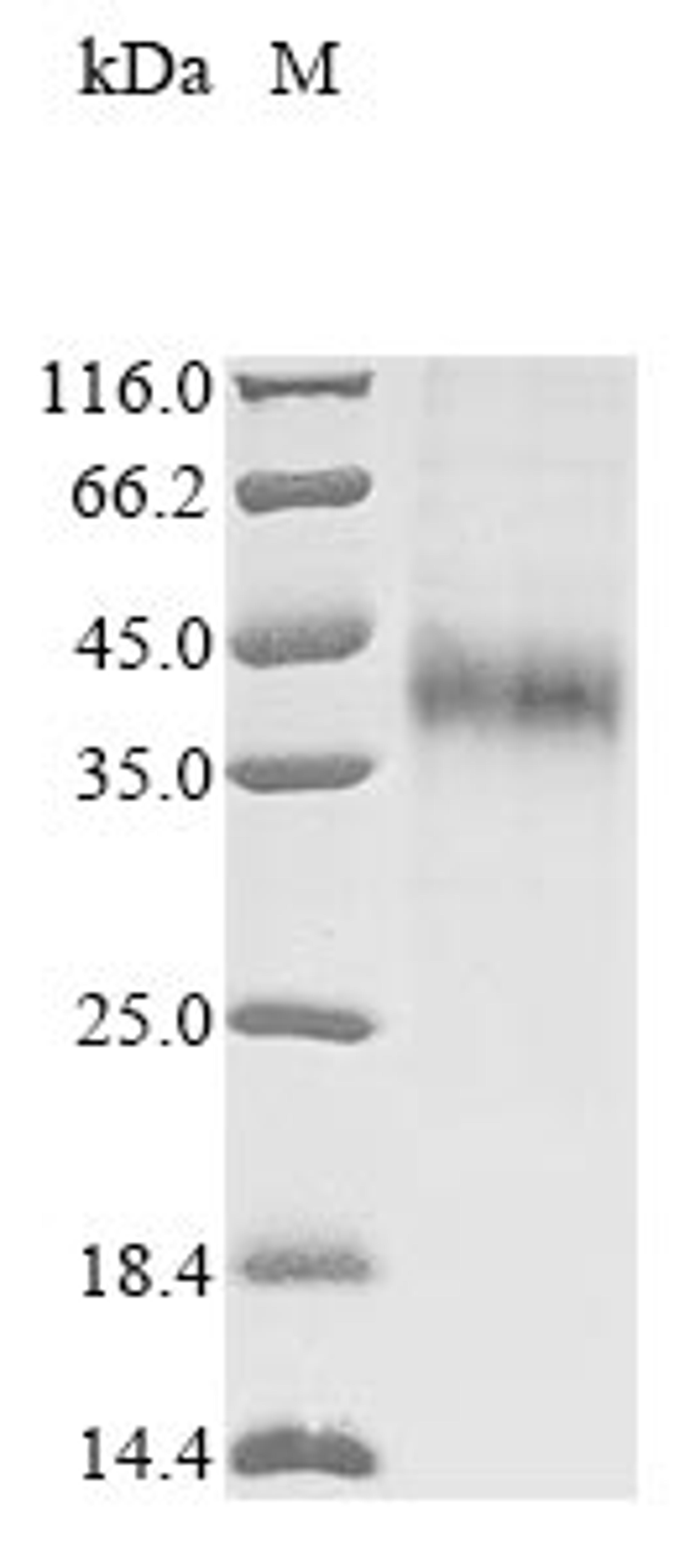 (Tris-Glycine gel) Discontinuous SDS-PAGE (reduced) with 5% enrichment gel and 15% separation gel.
