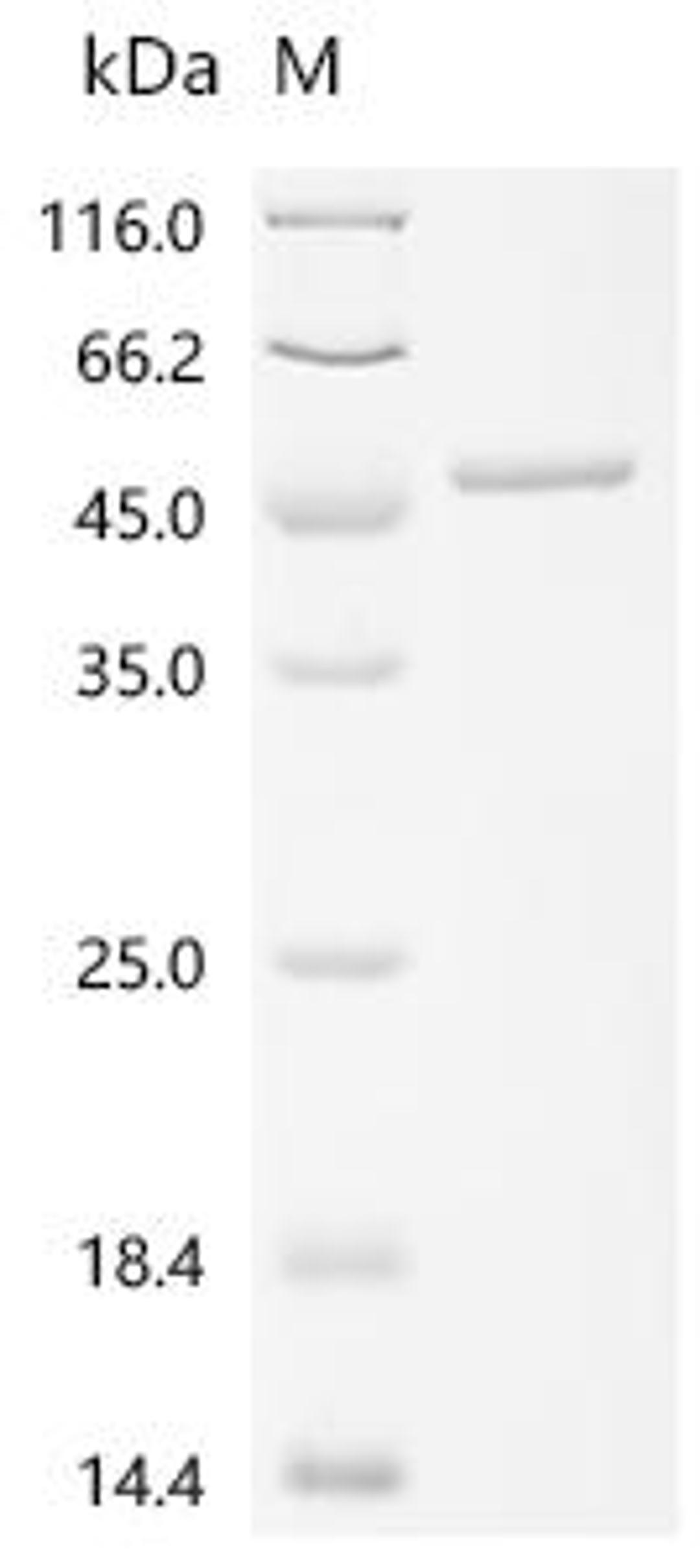 (Tris-Glycine gel) Discontinuous SDS-PAGE (reduced) with 5% enrichment gel and 15% separation gel.
