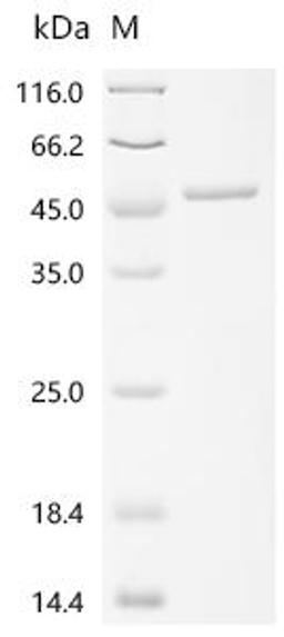 (Tris-Glycine gel) Discontinuous SDS-PAGE (reduced) with 5% enrichment gel and 15% separation gel.