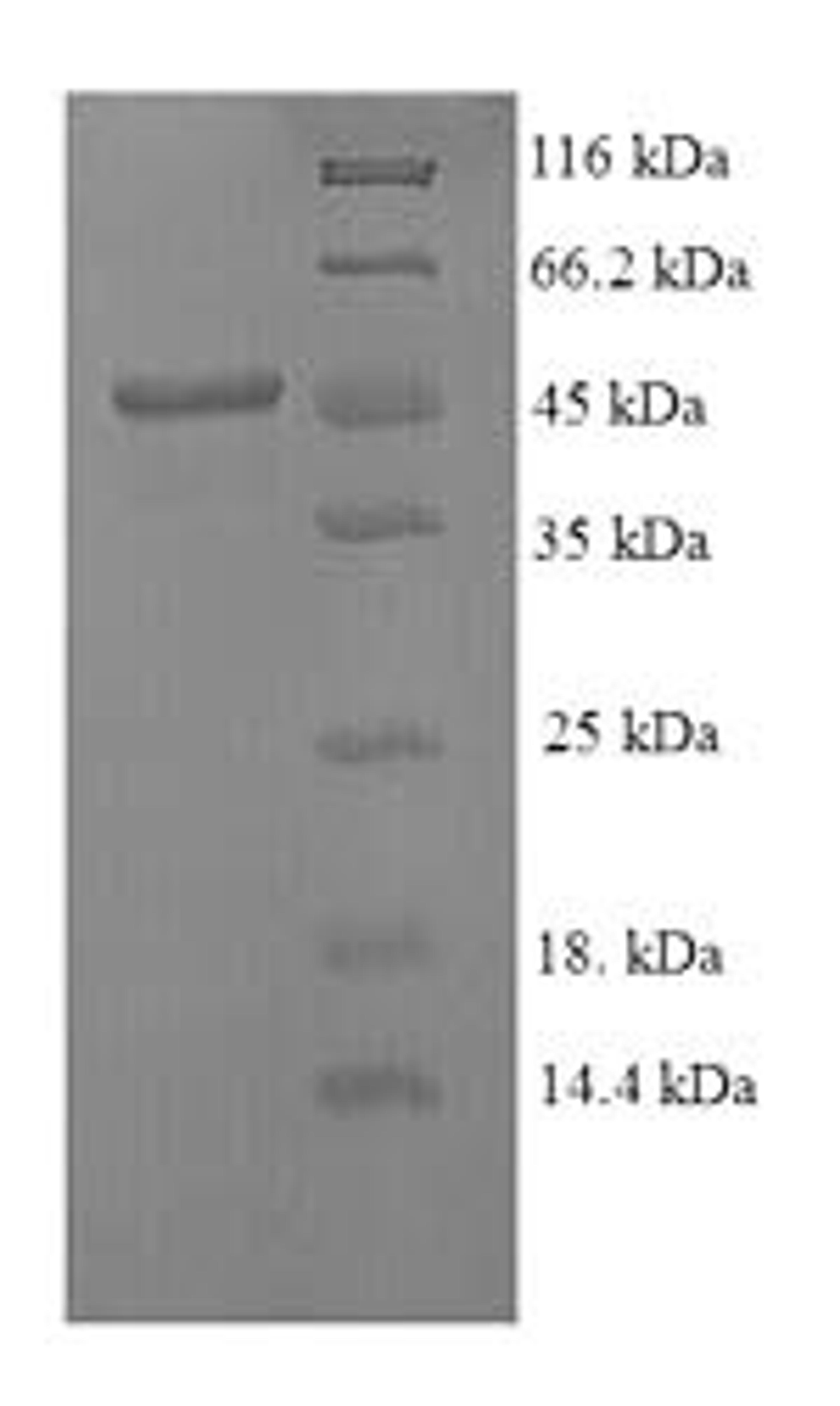 (Tris-Glycine gel) Discontinuous SDS-PAGE (reduced) with 5% enrichment gel and 15% separation gel.