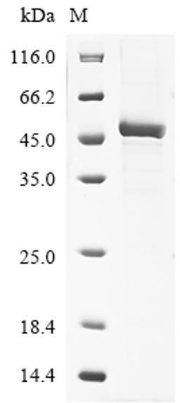 (Tris-Glycine gel) Discontinuous SDS-PAGE (reduced) with 5% enrichment gel and 15% separation gel.