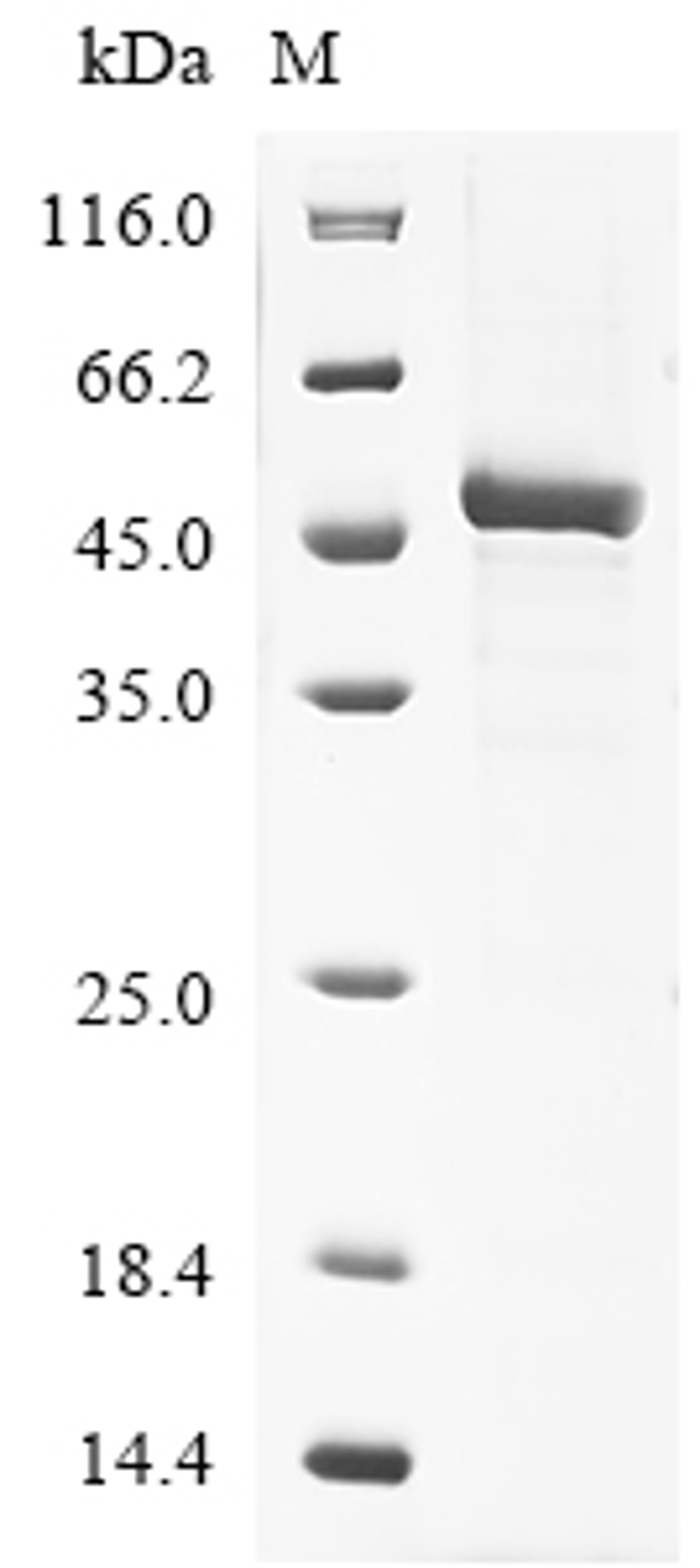 (Tris-Glycine gel) Discontinuous SDS-PAGE (reduced) with 5% enrichment gel and 15% separation gel.
