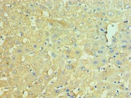 Immunohistochemistry of paraffin-embedded human liver tissue using CSB-PA015422ESR1HU at dilution of 1:100
