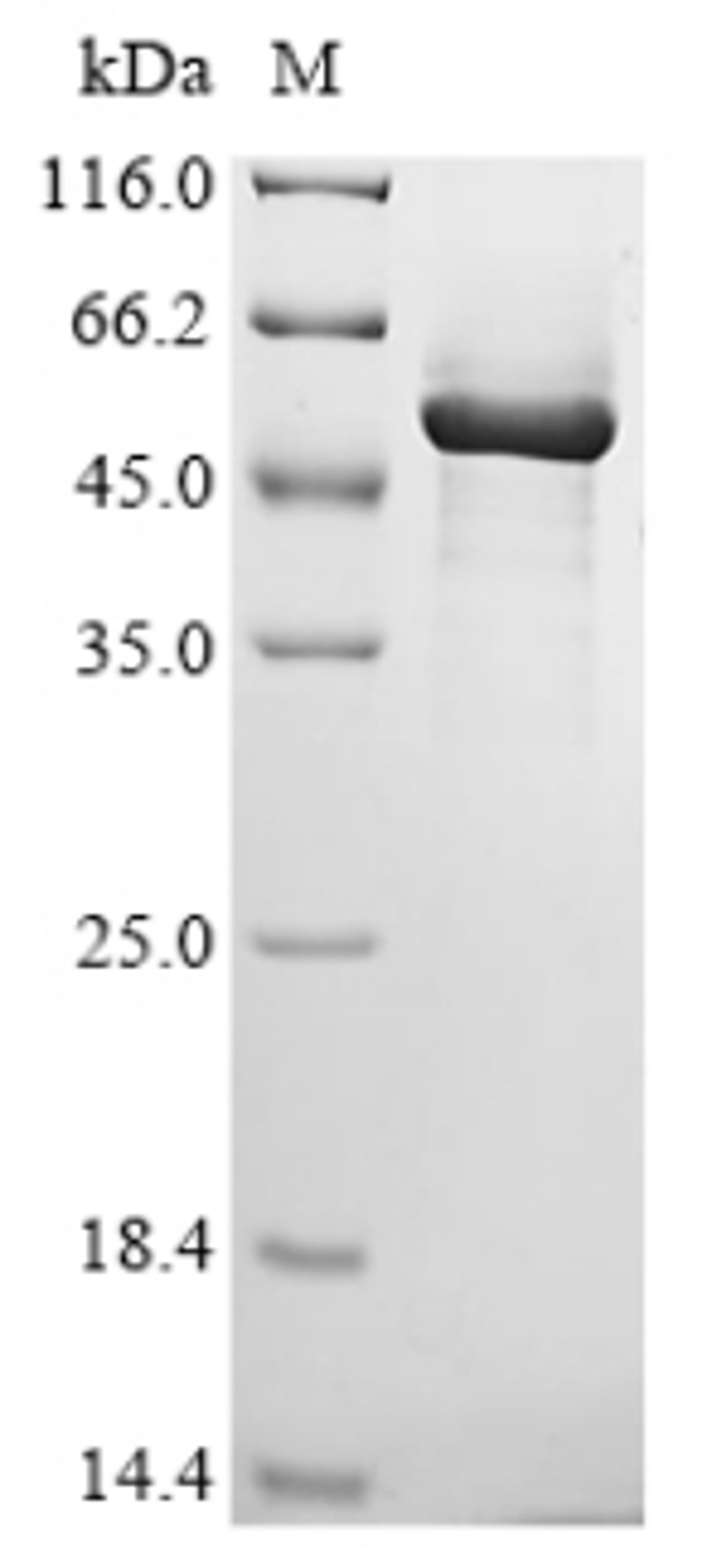 (Tris-Glycine gel) Discontinuous SDS-PAGE (reduced) with 5% enrichment gel and 15% separation gel.