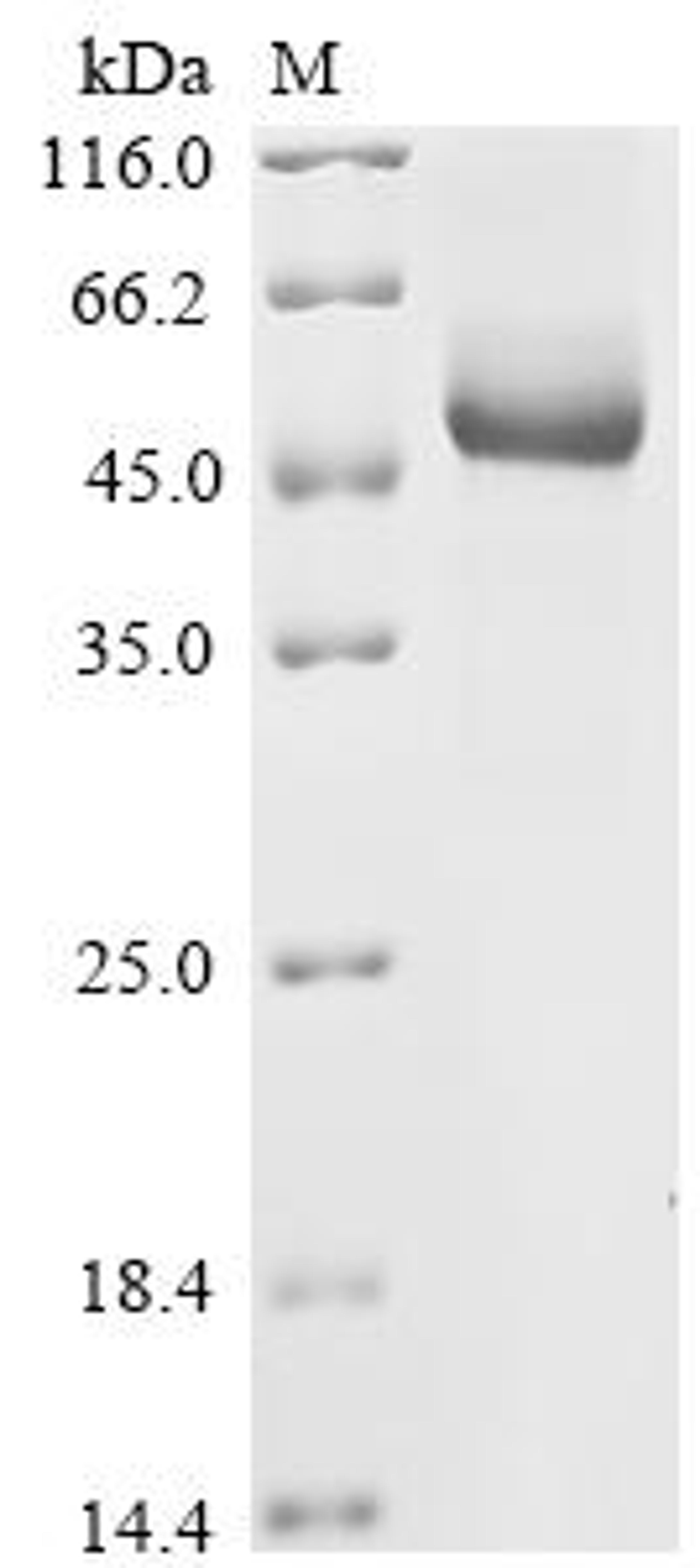 (Tris-Glycine gel) Discontinuous SDS-PAGE (reduced) with 5% enrichment gel and 15% separation gel.