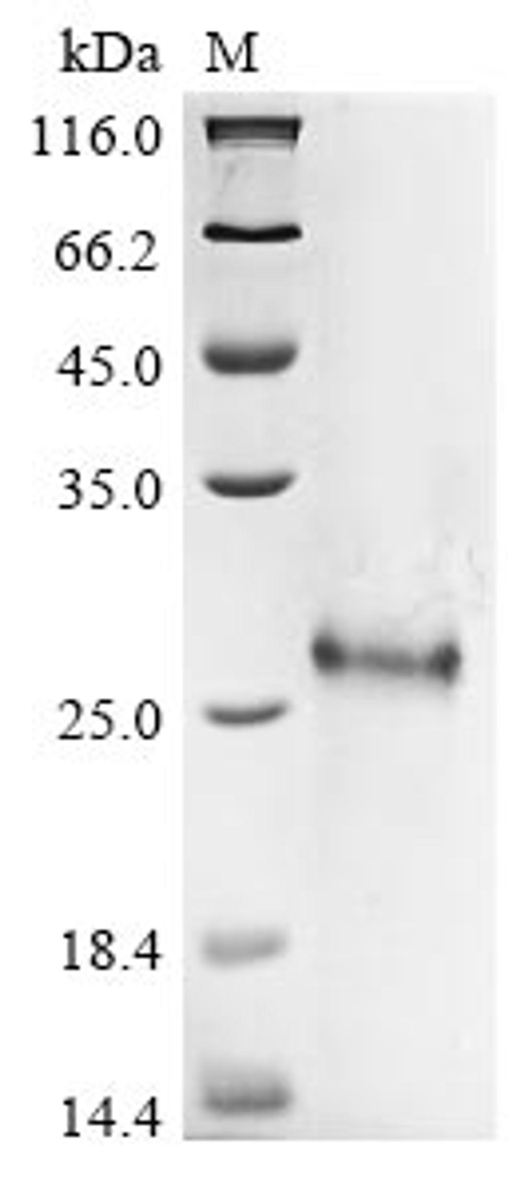 (Tris-Glycine gel) Discontinuous SDS-PAGE (reduced) with 5% enrichment gel and 15% separation gel.
