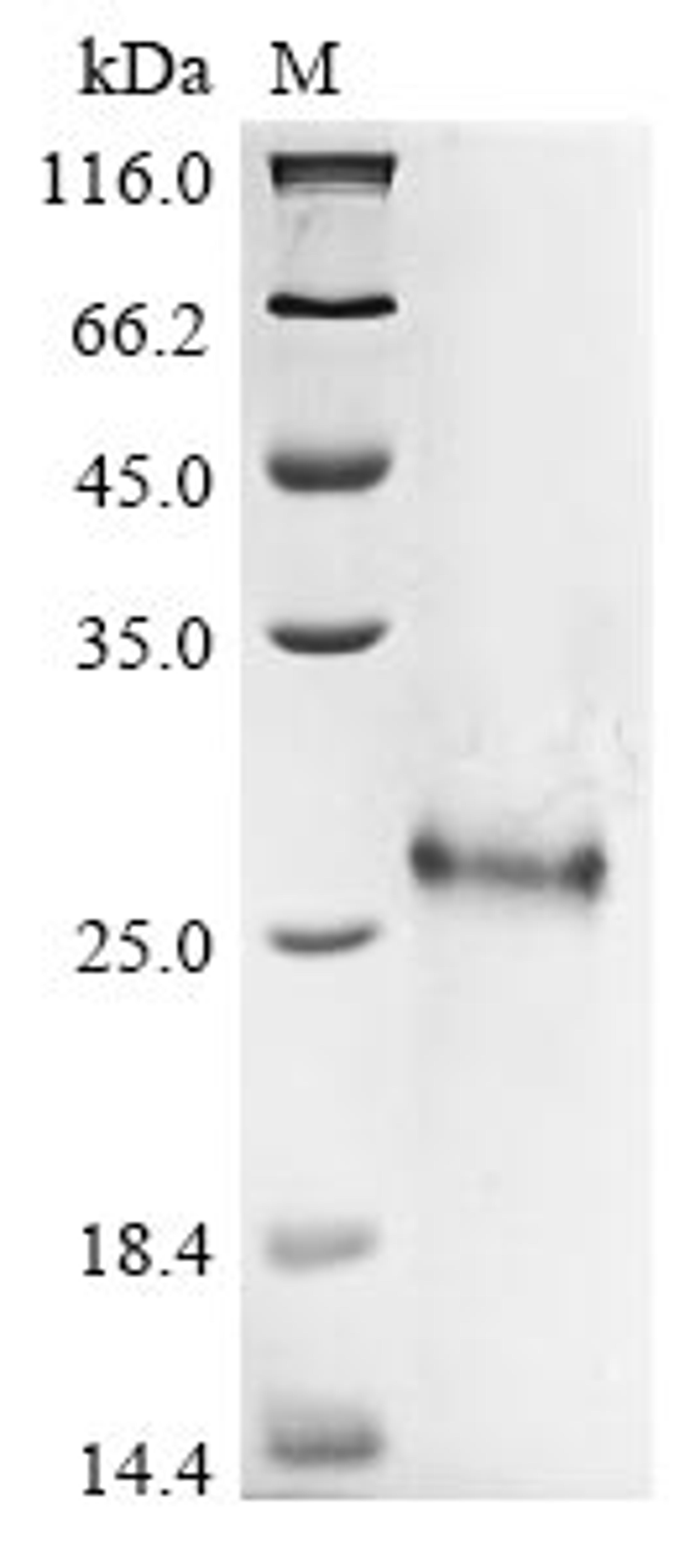 (Tris-Glycine gel) Discontinuous SDS-PAGE (reduced) with 5% enrichment gel and 15% separation gel.