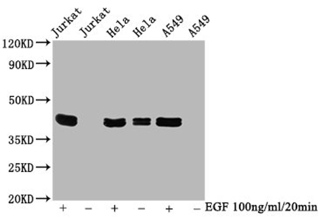 Western Blot. Positive WB detected in Jurkat whole cell lysate锛孒ela whole cell lysate锛孉549 whole cell lysate(treated with EGF or not). All lanes Phospho-MAPK3 antibody at 0.95μg/ml. Secondary. Goat polyclonal to rabbit IgG at 1/50000 dilution. Predicted band size: 42 KDa. Observed band size: 42 KDa. 